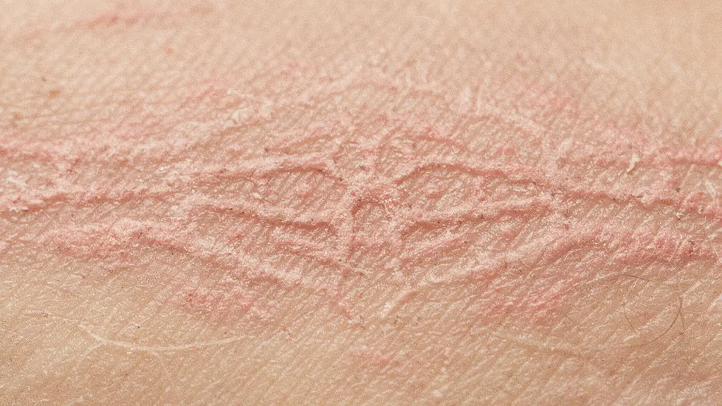 Nahaufnahme der Hautheilung nach Laserbehandlung in verschiedenen Phasen